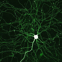 picture of a neuron